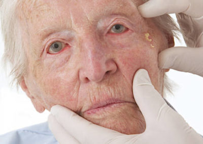 Elder abuse: spotting the signs and advice for carers